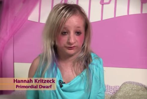 Girl With Dwarfism Inspires People Around the World